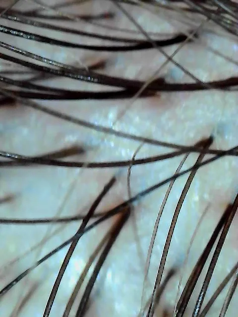 Real scalp after one head spa treatment with clear, calm skin and visible follicles, The Beauty of Zen Worcester MA